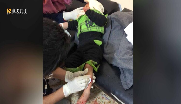 An injured child due to Turkish shelling on Ain Issa – North Press