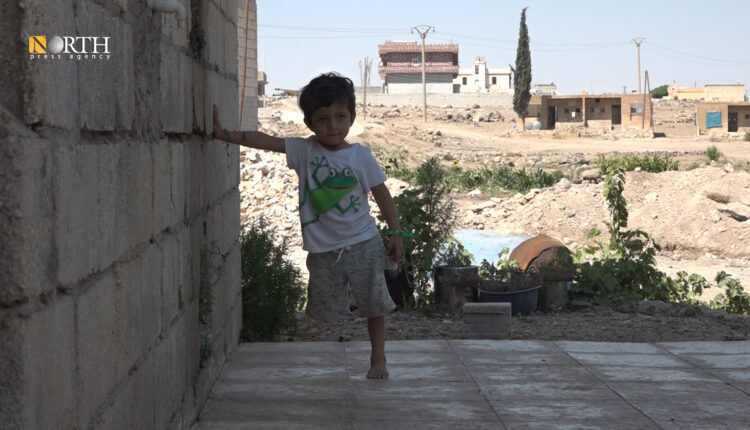 Child Ebdo Hanifi, whose leg was previously amputated in Turkish shelling of the village of Qaramogh east of Kobani - North Press