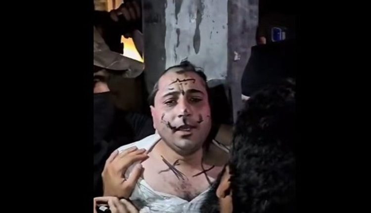 image shows omar khairi after assault in northern Aleppo