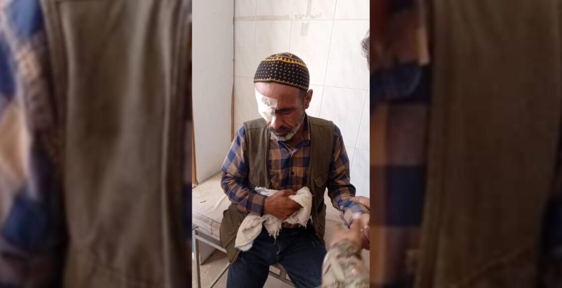 إصابة رجل بقصف مسيرة تركية في تل رفعت - متداول