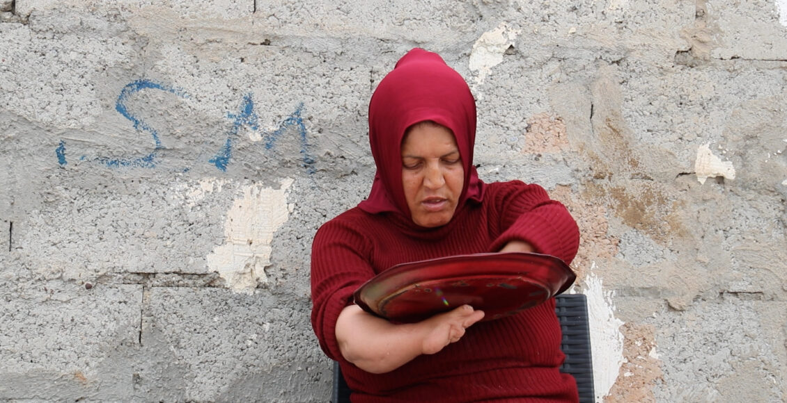 اللاجئة السورية لبنى علي ديب في ظروف صحية قاسية بأربيل ـ نورث برس