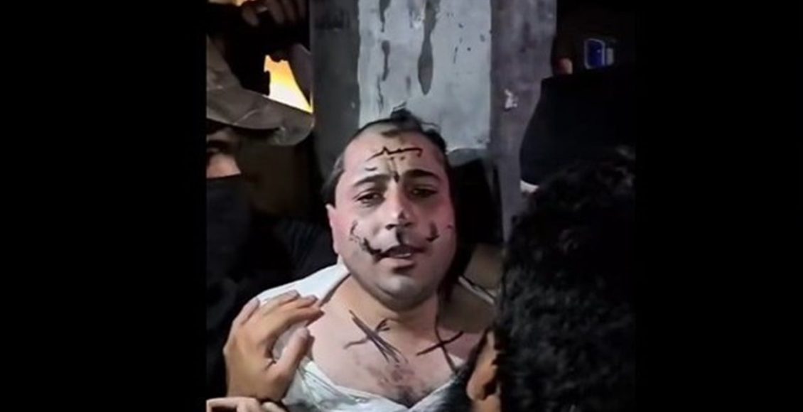 صورة للاعتداء على المطرب الشعبي عمر خيري